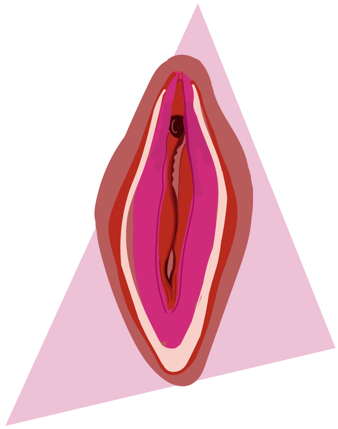 tipos de vulva vergonzosa